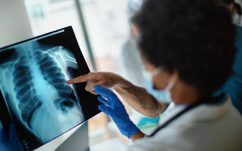 Resource Finder recruits radiologists in India ©Aja-Koska, iStock